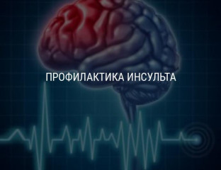 Профилактика инсульта.